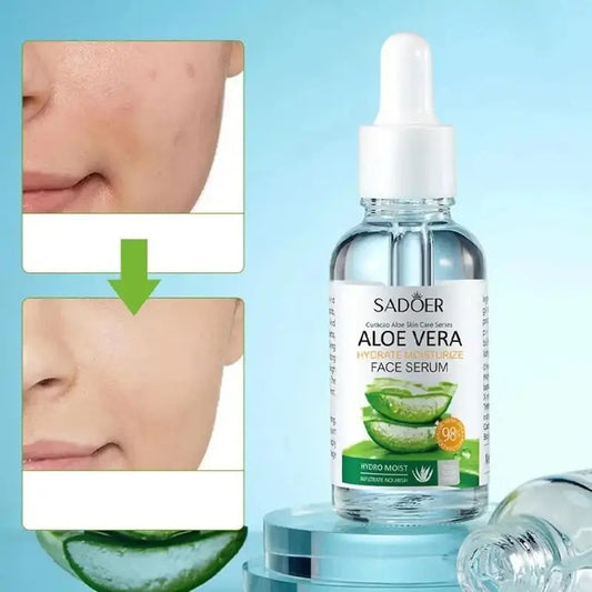 SADOER Pure Aloe Vera Gel 2-Piece Kit, 2x30ml, Fast Absorption, Suitable For All Skin Types-Selling On TEMU Is Prohibited